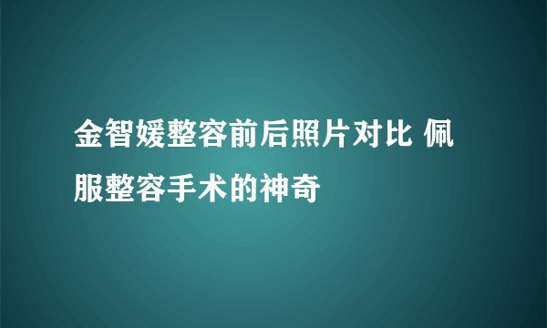 金智媛整容前后照片对比 佩服整容手术的神奇