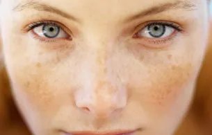 祛斑哪家医院好