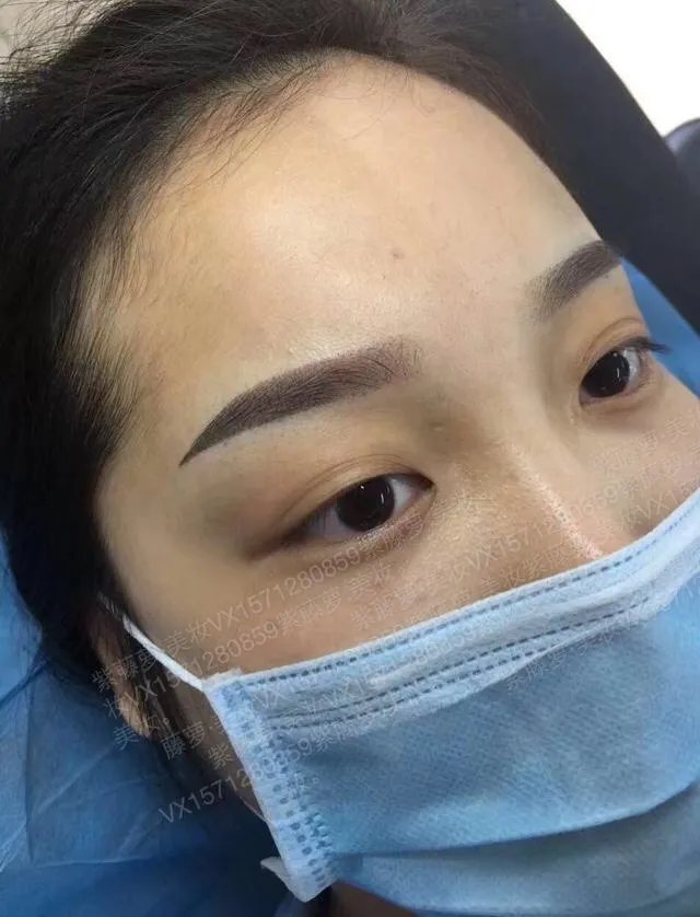 女子纹眉成熊猫眼，女生整形前都不考虑风险么？