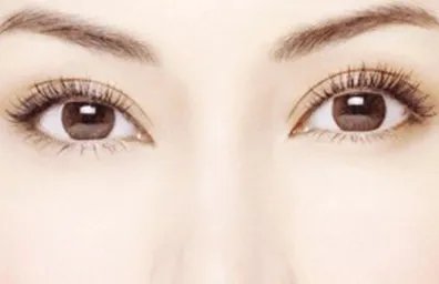 内切祛眼袋优点