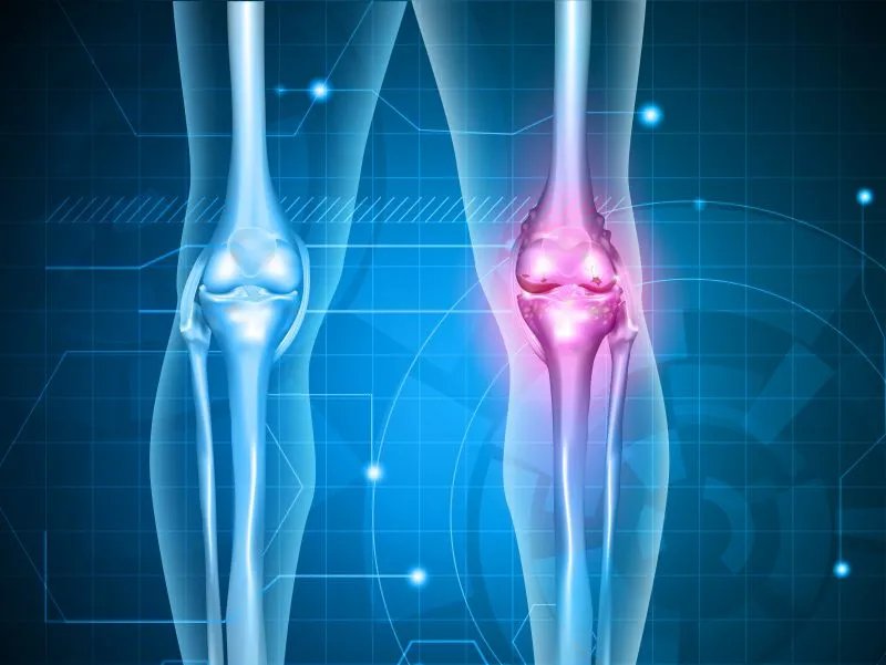 关节炎有什么治疗方法