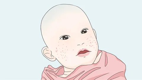宝宝脸上起红疙瘩怎么回事