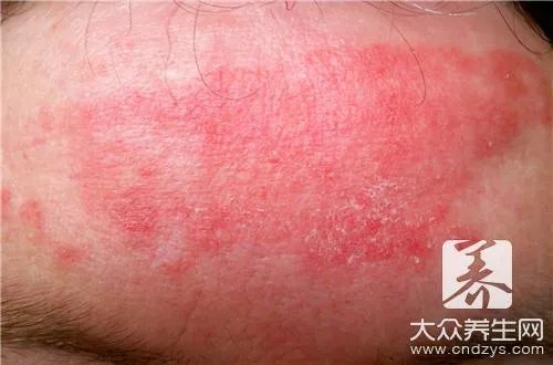 寻麻诊是怎么回事