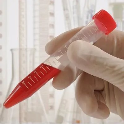 隐血3+代表什么