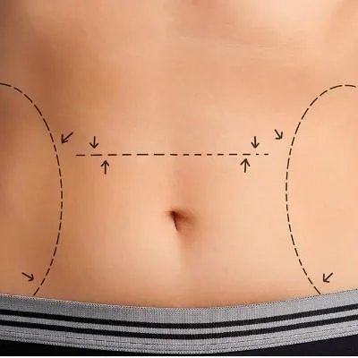 女人减肥的方法