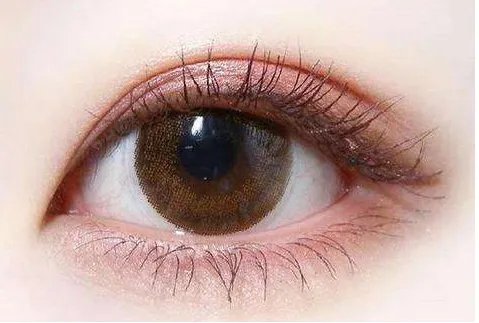 切割双眼皮怎么做