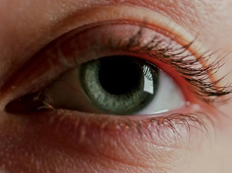 黑眼珠发黄是为什么