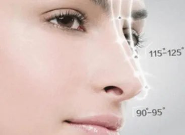 玻尿酸隆鼻价钱一般多少