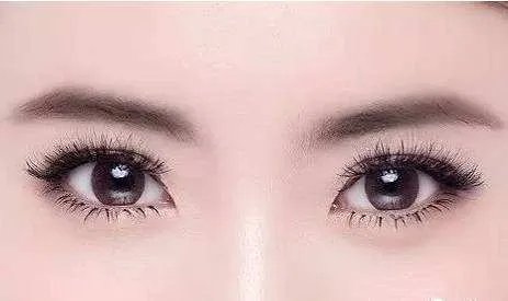 割双眼皮开眼角的费用