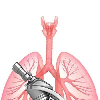 抗肺癌进口药有哪些