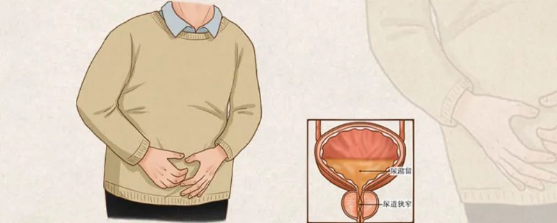 小便很黄是什么原因