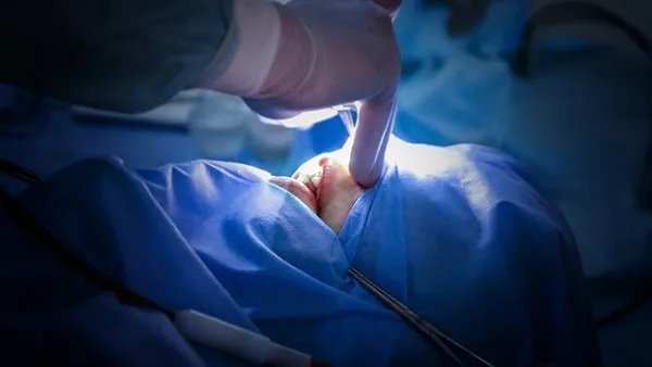 无痛手术是怎么做的