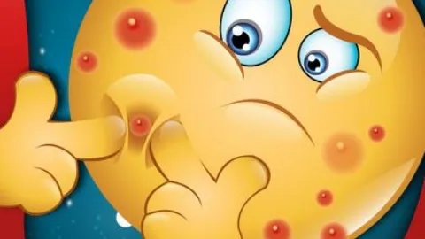 嘴角长痘什么原因