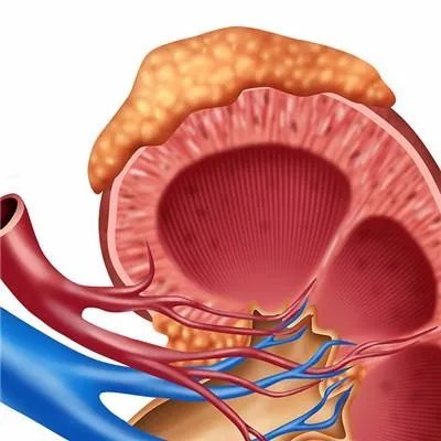 肾病有什么治疗的方法