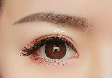 做双眼皮埋线怎么做