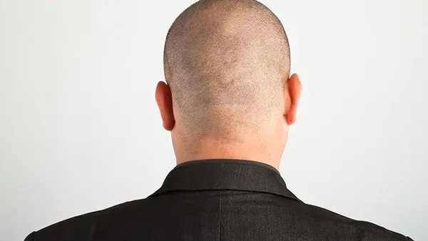 发情线高适合什么发型？