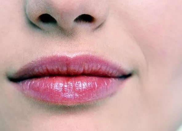 玻尿酸丰唇珠价格