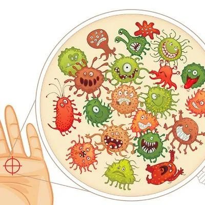 牛皮癣怎么治疗