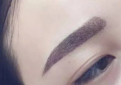 植眉毛需要多少钱