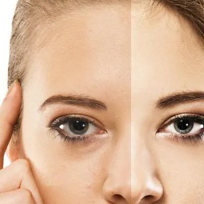 如何让毛孔缩小