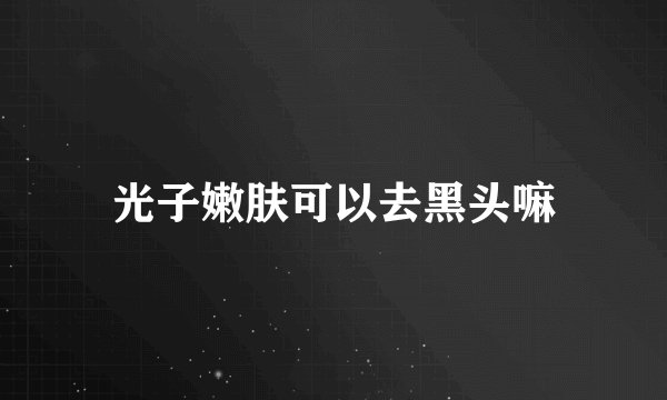 光子嫩肤可以去黑头嘛