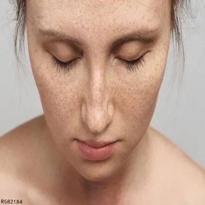 用什么祛斑有效