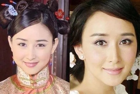 胡静整容前后照片对比 圆脸竟变锥子脸