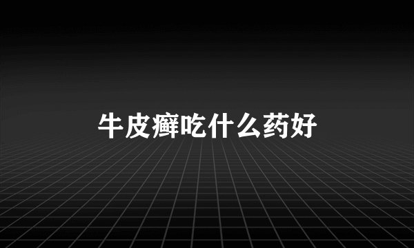 牛皮癣吃什么药好