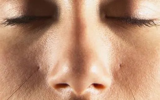 缩鼻头缺点