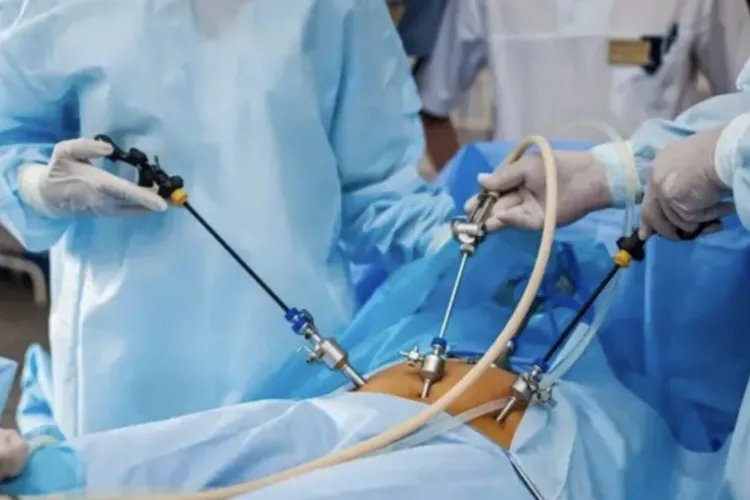 微创手术是什么样的手术