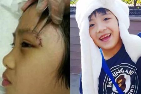 吴镇宇晒费曼近照 神情憔悴眼角疤痕明显