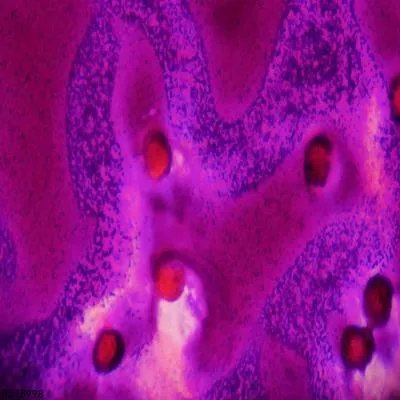 血小板减少会有什么危害 浅析血小板减少的四个危害