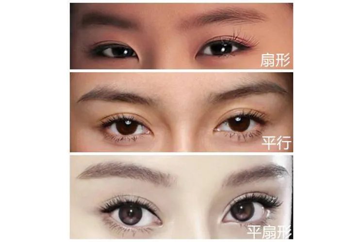 双眼皮分为哪几种类型图片
