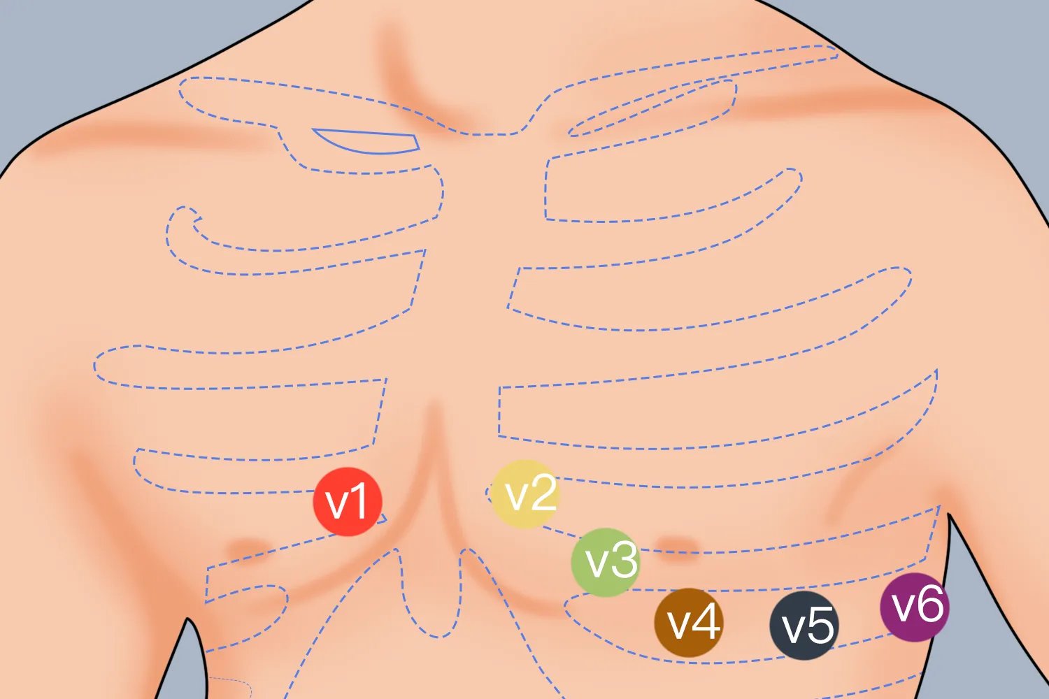十二导联位置图解