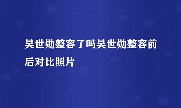 吴世勋整容了吗吴世勋整容前后对比照片