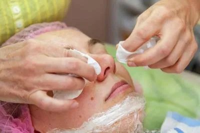 怎么清理脸上的粉刺黑头螨虫