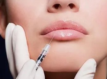 面颊填充玻尿酸效果