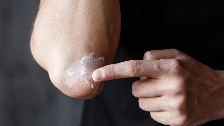 影响祛脸部黄褐斑价格因素