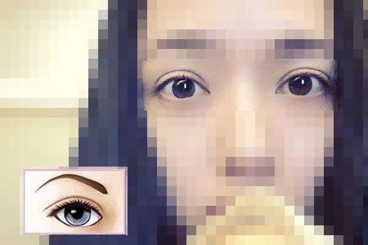 双眼皮分为哪几种类型图片