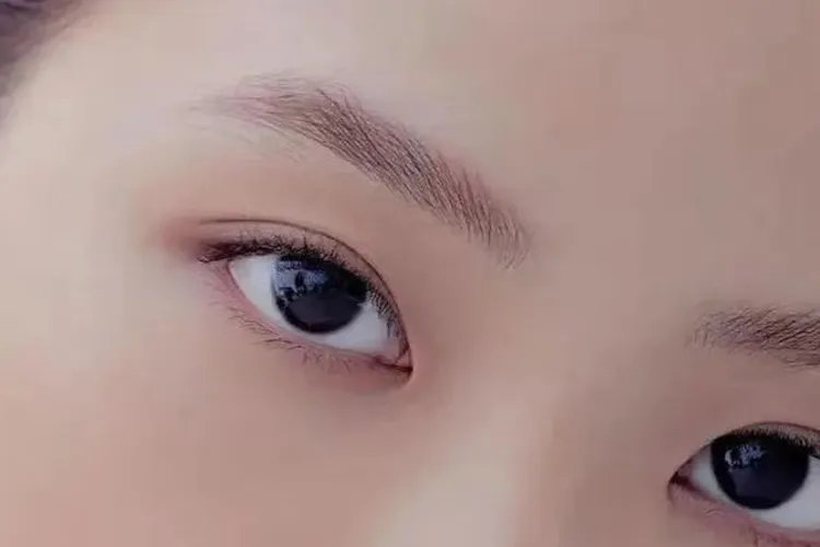 双眼皮分为哪几种类型图片