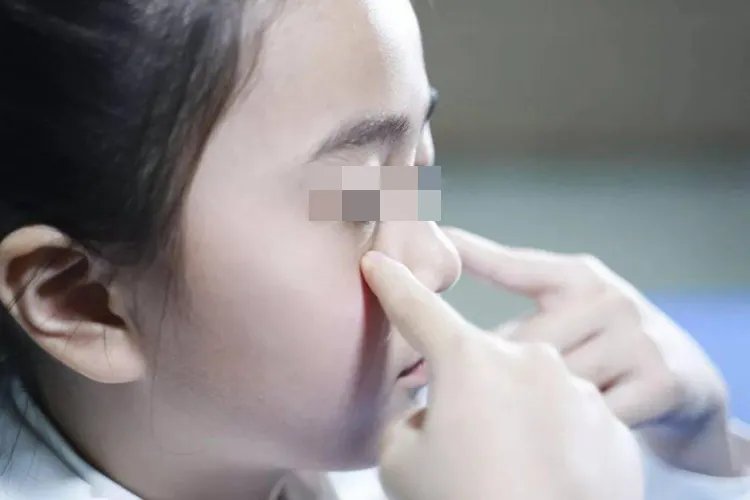 眼睛疲劳怎么按摩图解