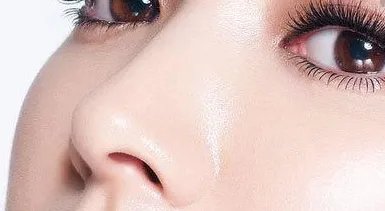 蒜头鼻整形后遗症