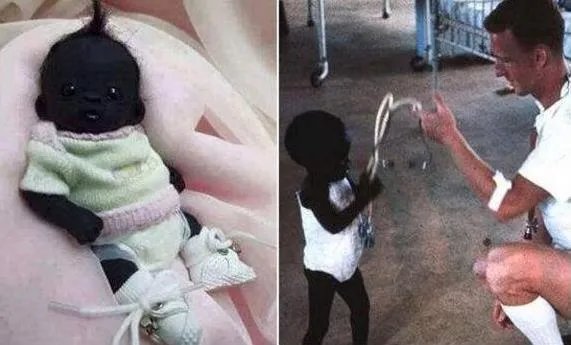 世界上最黑的孩子图片：真实黑孩子创人类新高度