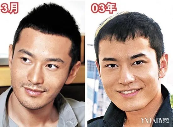 黄晓明整容前后照片对比“肉脸照”曝光