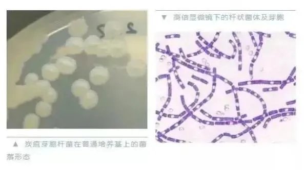 山东出现炭疽死亡病例！至少三地有人确诊，它是如何进行传播的？