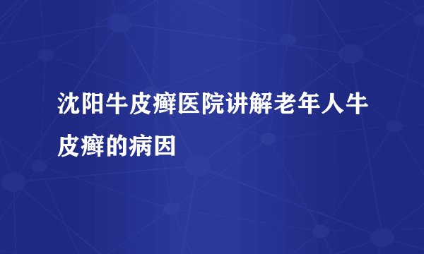 沈阳牛皮癣医院讲解老年人牛皮癣的病因