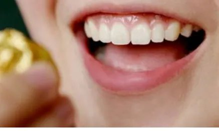 微创种植牙多少钱