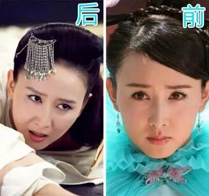 胡静整容前后照片对比 圆脸竟变锥子脸