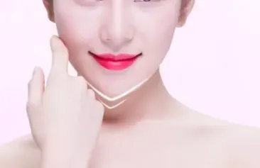 假体隆下巴价格