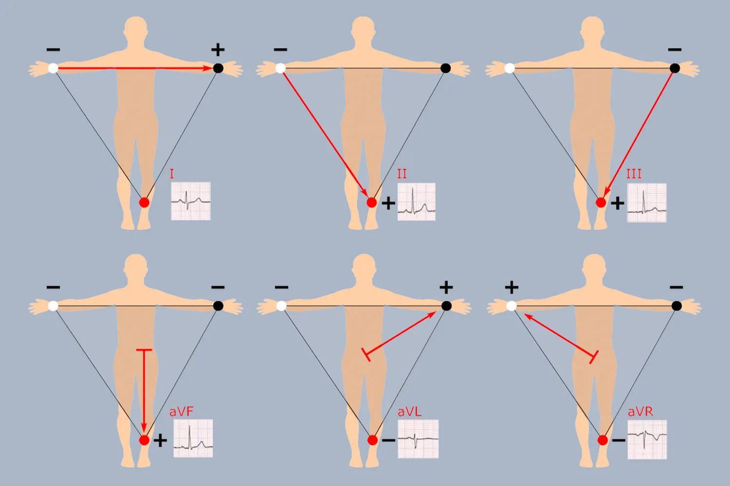 十二导联位置图解
